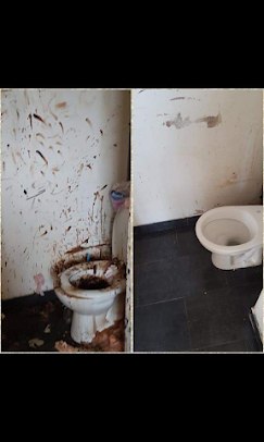Avant après : désinfection et remise en état de toilettes par GSI 3D